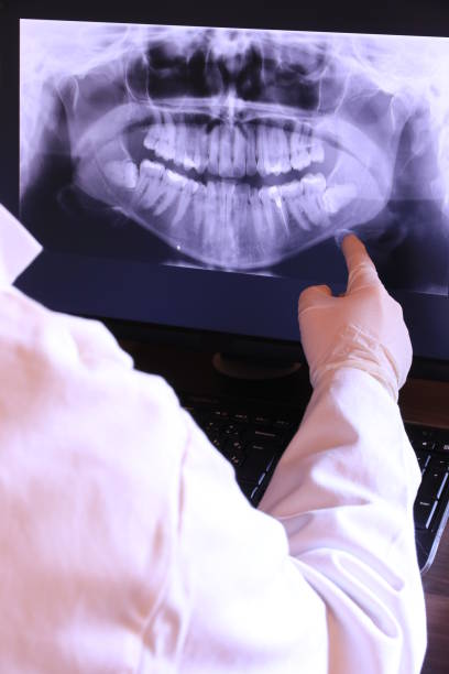 Best Emergency Root Canal Treatment in Princeton, TX